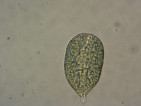 Image of Gonyostomum semen