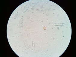 Image of Ascocoryne cylichnium (Tul.) Korf 1971