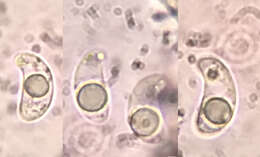 Image of Rutstroemia sydowiana (Rehm) W. L. White 1941