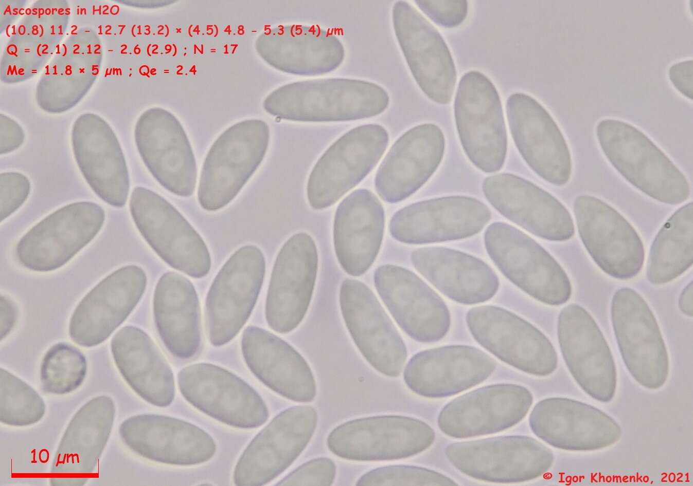 Image of Moellerodiscus capillipes (Quél.) M. P. Sharma 1986