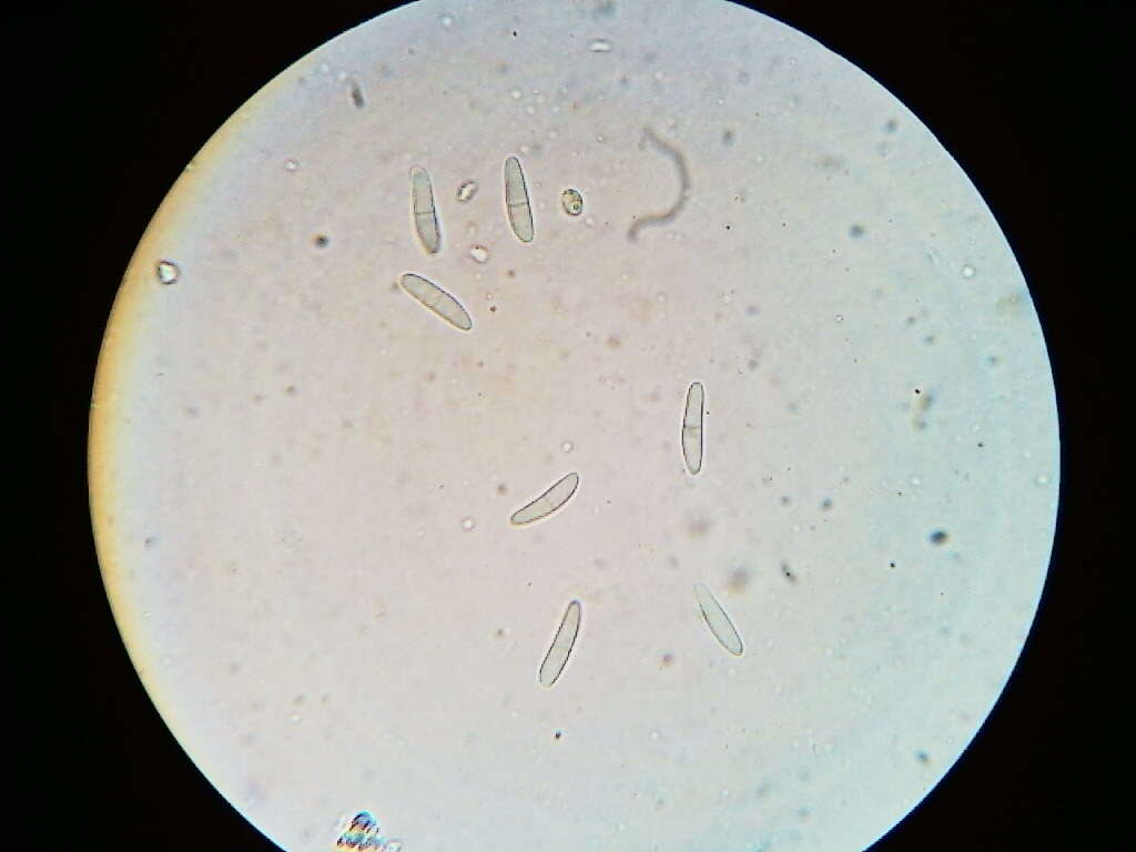 Imagem de Arachnopeziza trabinelloides (Rehm) Korf 1952