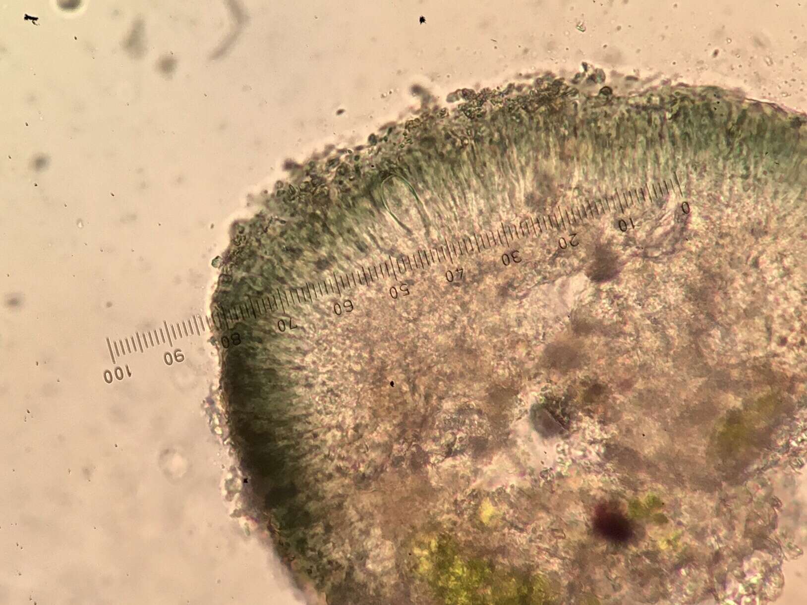 Image of strangospora lichen