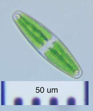 Image of Closterium navicula