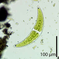 Image of Closterium moniliferum