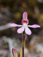 Image of White fingers