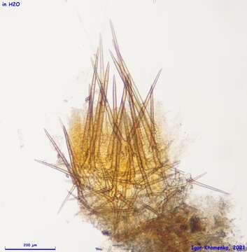 Image of Cheilymenia stercorea (Pers.) Boud. 1907