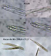 Image of Aeruginoscyphus sericeus (Alb. & Schwein.) Dougoud 2012