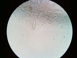 Image of Ascocoryne cylichnium (Tul.) Korf 1971