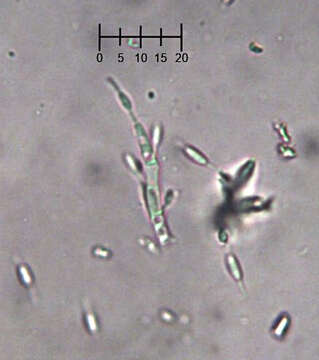 Image of Eleutheromyces subulatus (Tode) Fuckel 1870