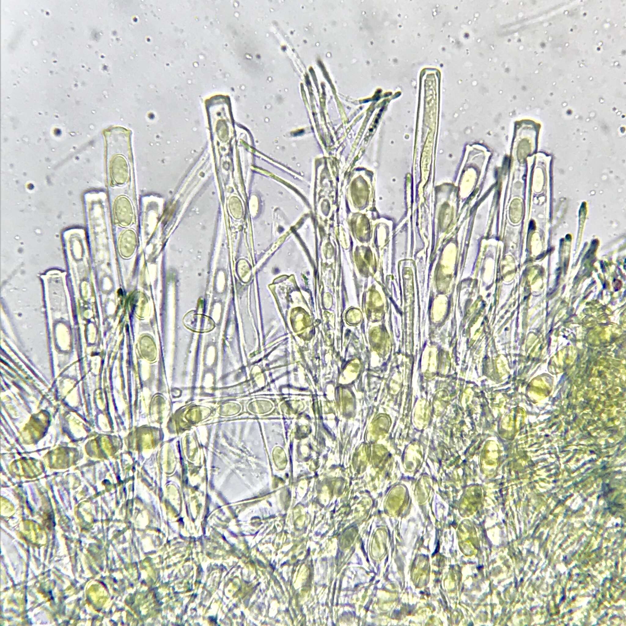 Image of Pseudopithyella minuscula (Boud. & Torrend) Seaver 1928