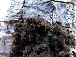 Image of skin lichen