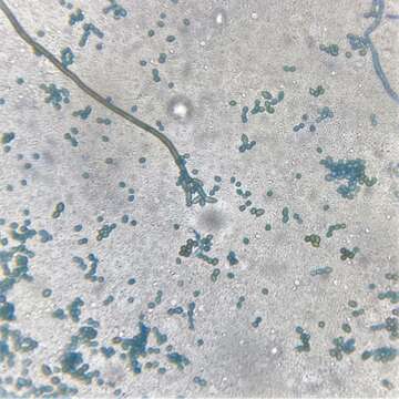 Imagem de Cladosporium perangustum Bensch, Crous & U. Braun 2010