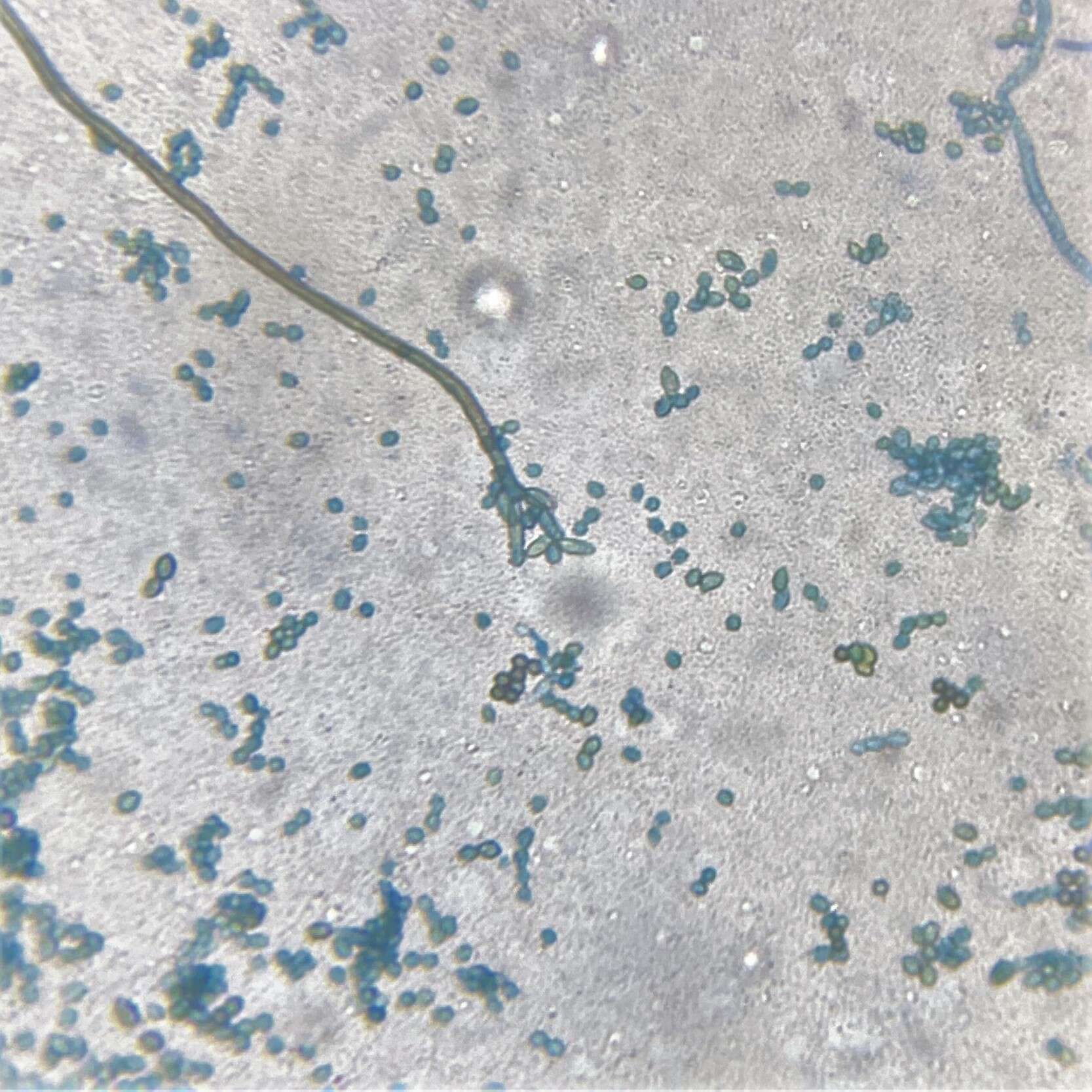 Image of Cladosporium perangustum Bensch, Crous & U. Braun 2010