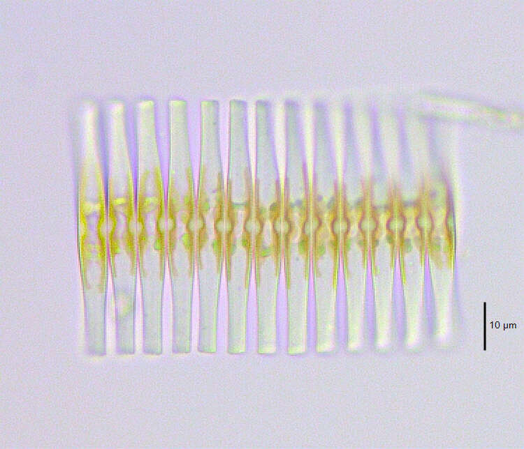 Слика од Fragilaria crotonensis