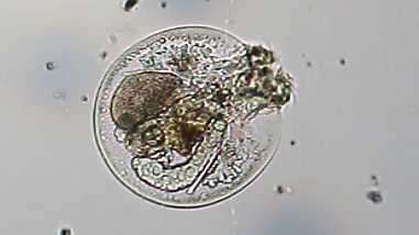 Image of turtle rotifer