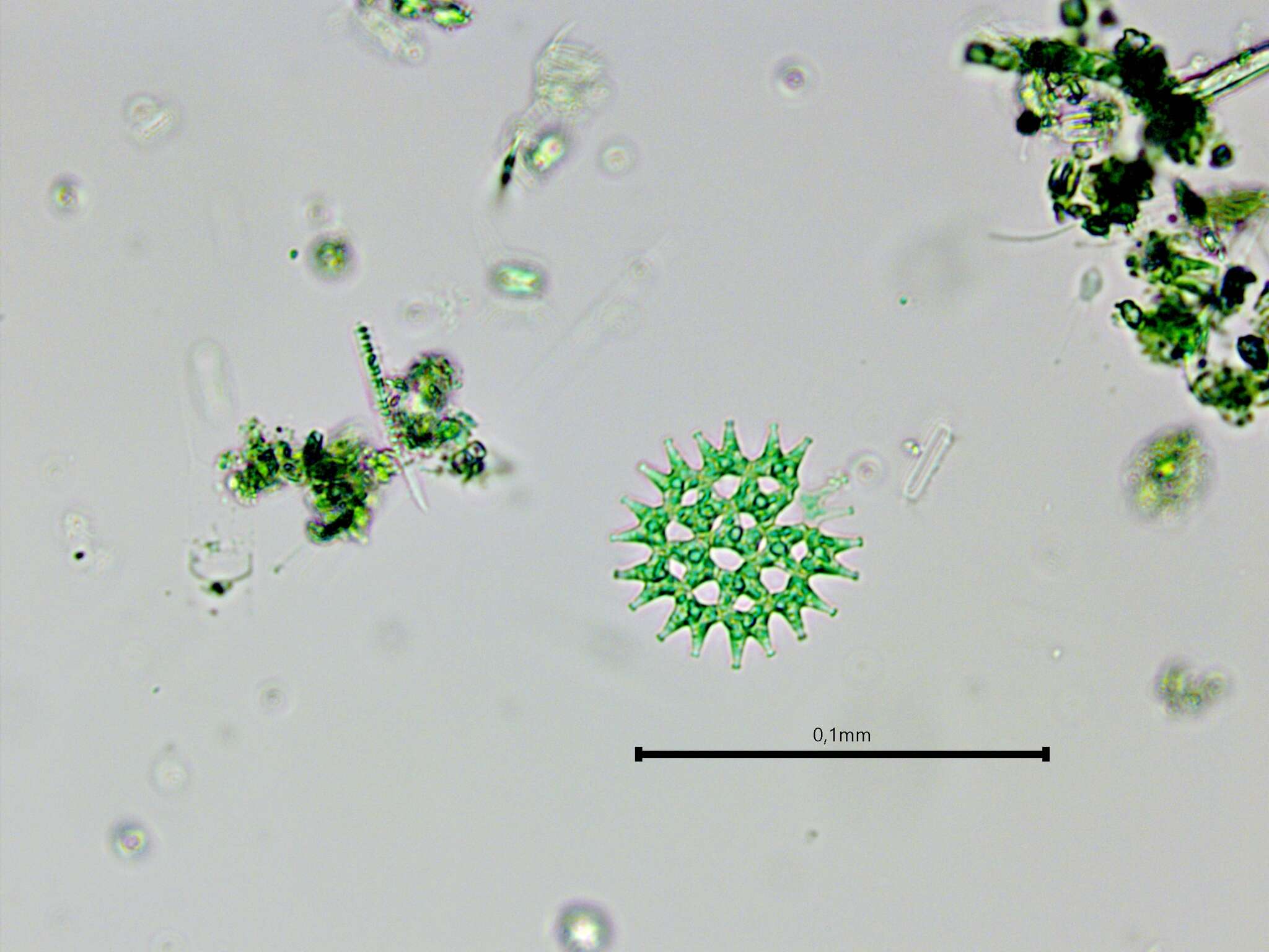 Plancia ëd Pediastrum duplex