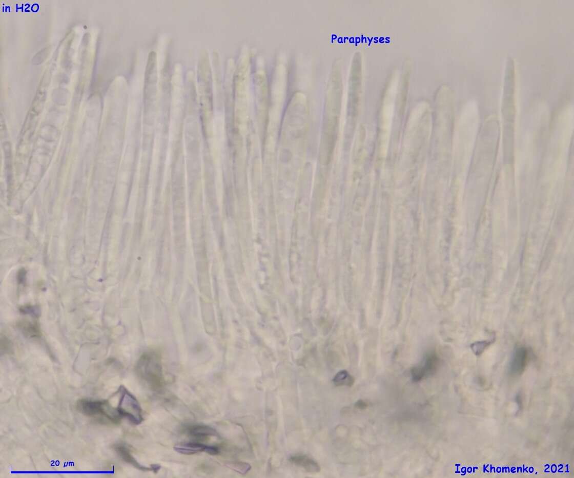 Image of Psilachnum inquilinum (P. Karst.) Dennis 1962