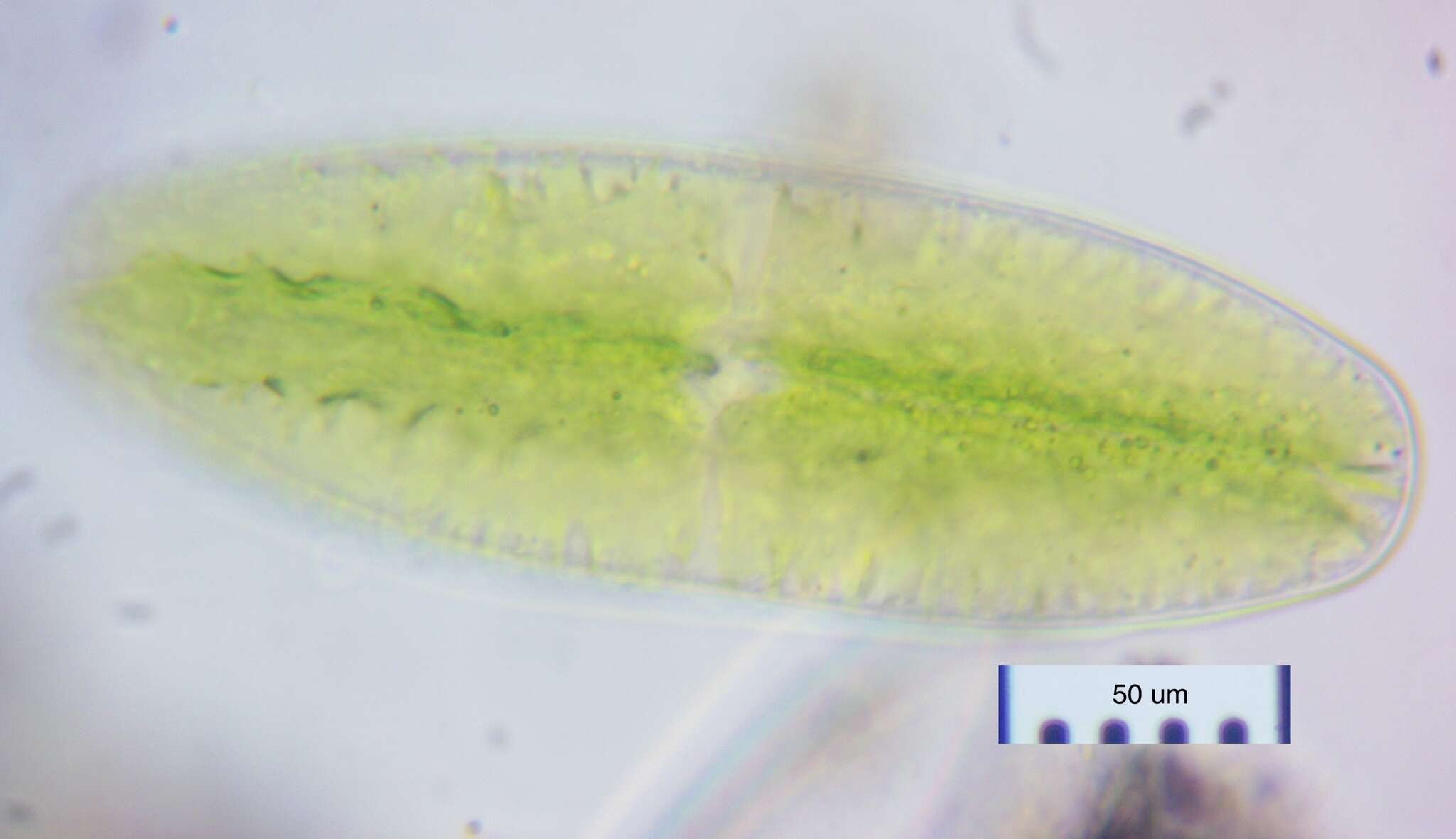 Netrium (Naegeli) Itzigsohn & Rothe 1856的圖片