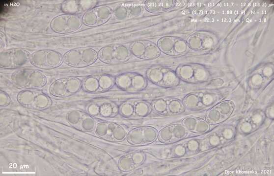 Image de Tarzetta catinus (Holmsk.) Korf & J. K. Rogers 1971