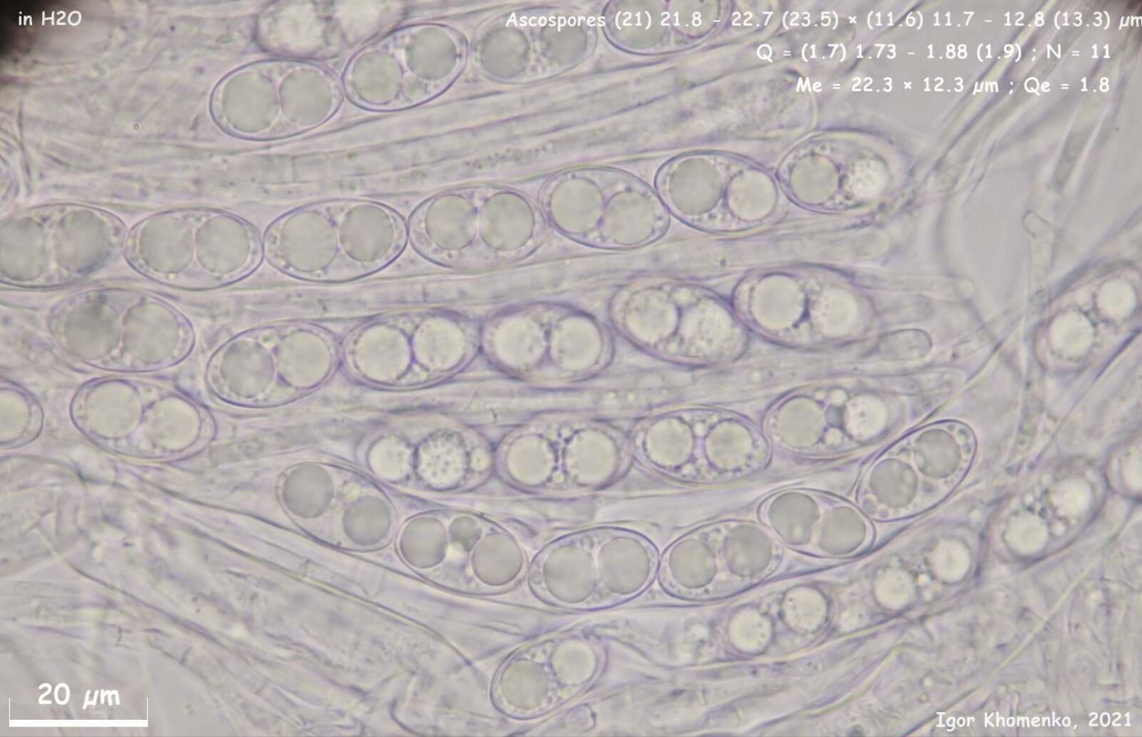 Image of Tarzetta catinus (Holmsk.) Korf & J. K. Rogers 1971