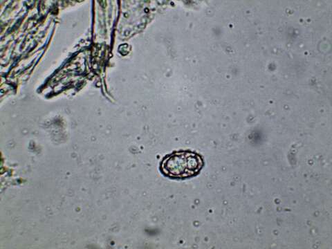 Imagem de Pachyella celtica (Boud.) Häffner 1993