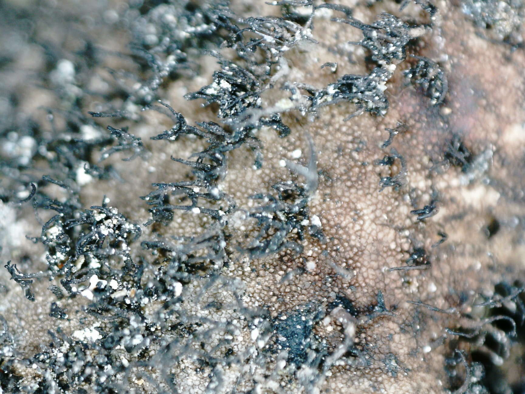 Image of navel lichen