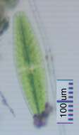 Netrium (Naegeli) Itzigsohn & Rothe 1856的圖片