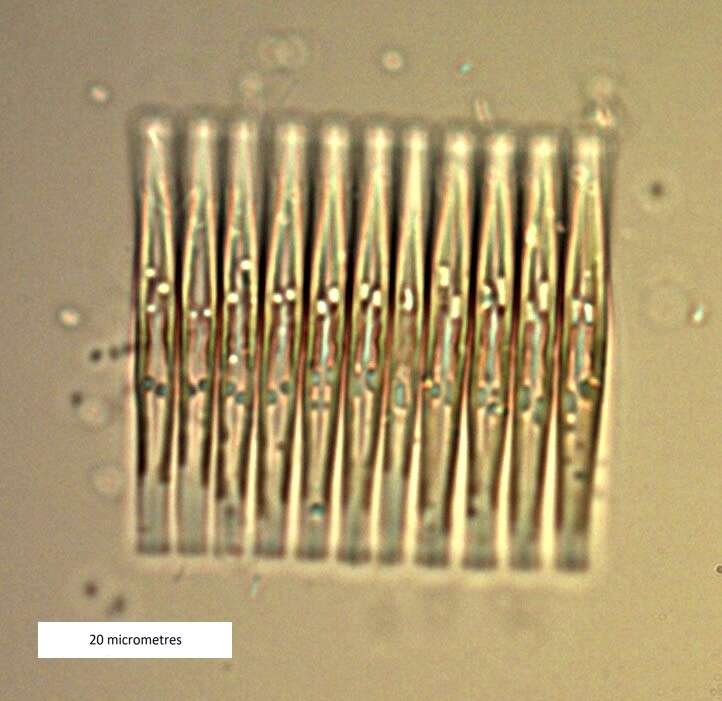Слика од Fragilaria crotonensis