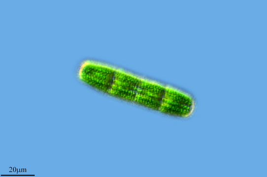 Image of <i>Penium margaritaceum</i>