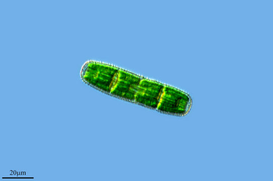 Image of <i>Penium margaritaceum</i>