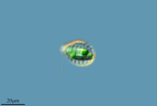 Image of <i>Paulinella chromatophora</i>