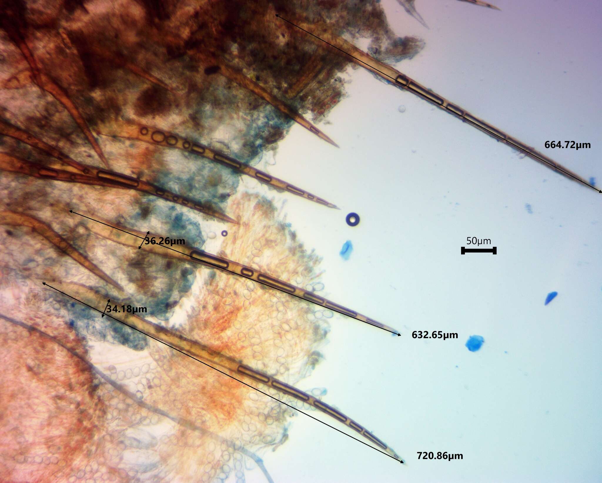 Image of Scutellinia vitreola Kullman 1982