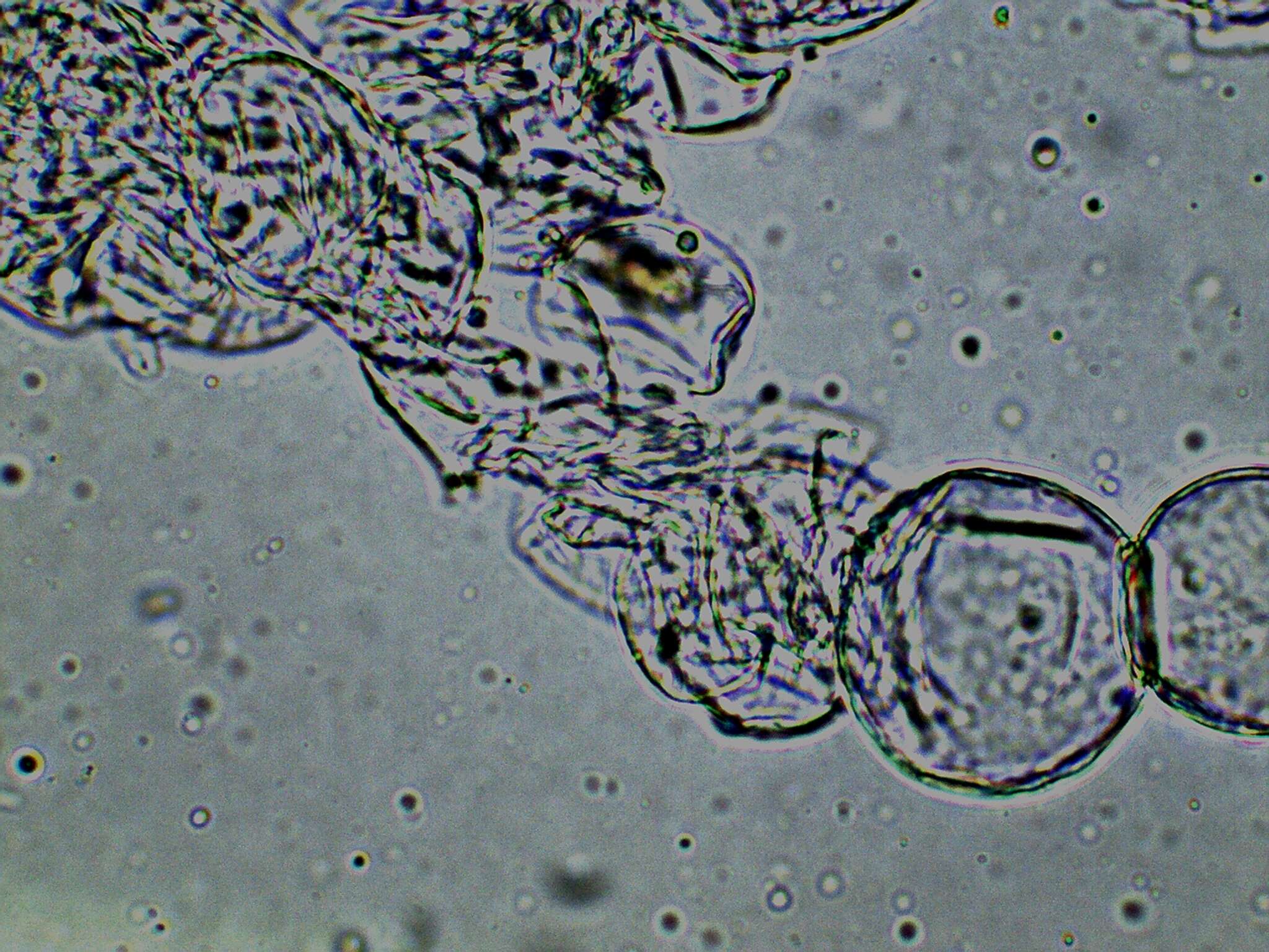 Image of Cystolepiota seminuda (Lasch) Bon 1976