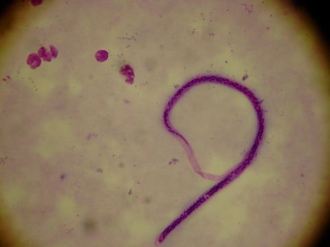 Image of <i>Wuchereria bancrofti</i> (Cobbold 1877)