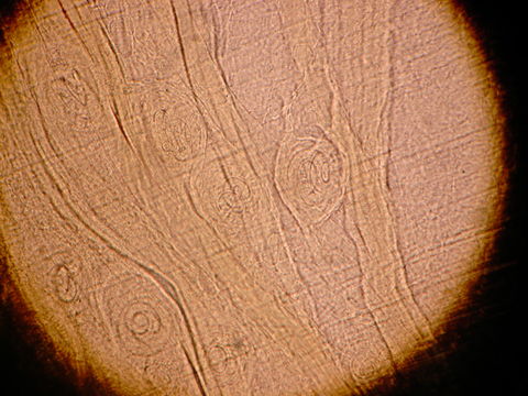 Image of <i>Trichinella spiralis</i> (Owen 1835)
