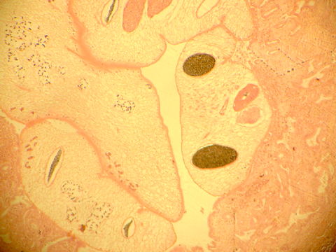 Image of Chinese River Fluke