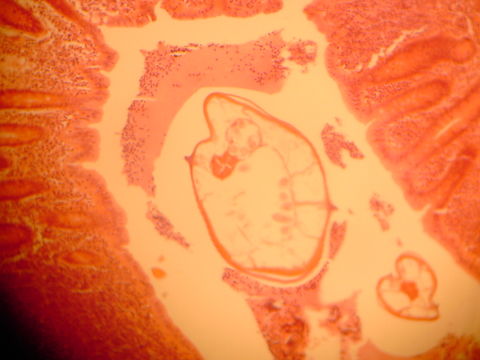 Image of <i>Enterobius vermicularis</i>