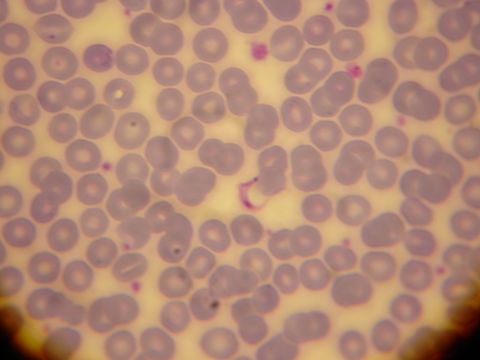 Image of <i>Trypanosoma cruzi</i>