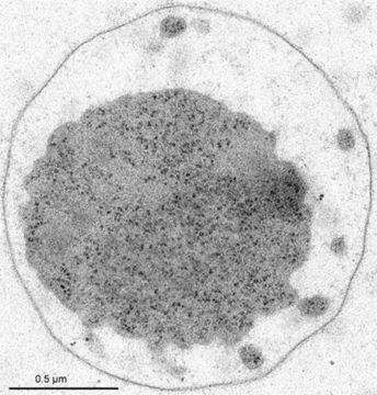 Image of <i>Ignicoccus hospitalis</i>
