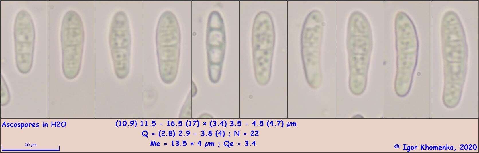 Image of Cresponea chloroconia (Tuck.) Egea & Torrente