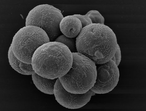 Image of <i>Sphaeroforma arctica</i>