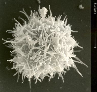 Image of <i>Acanthamoeba castellanii</i>