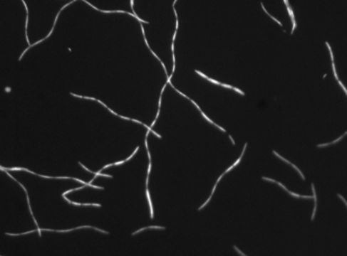 Слика од <i>Methanospirillum hungatei</i>