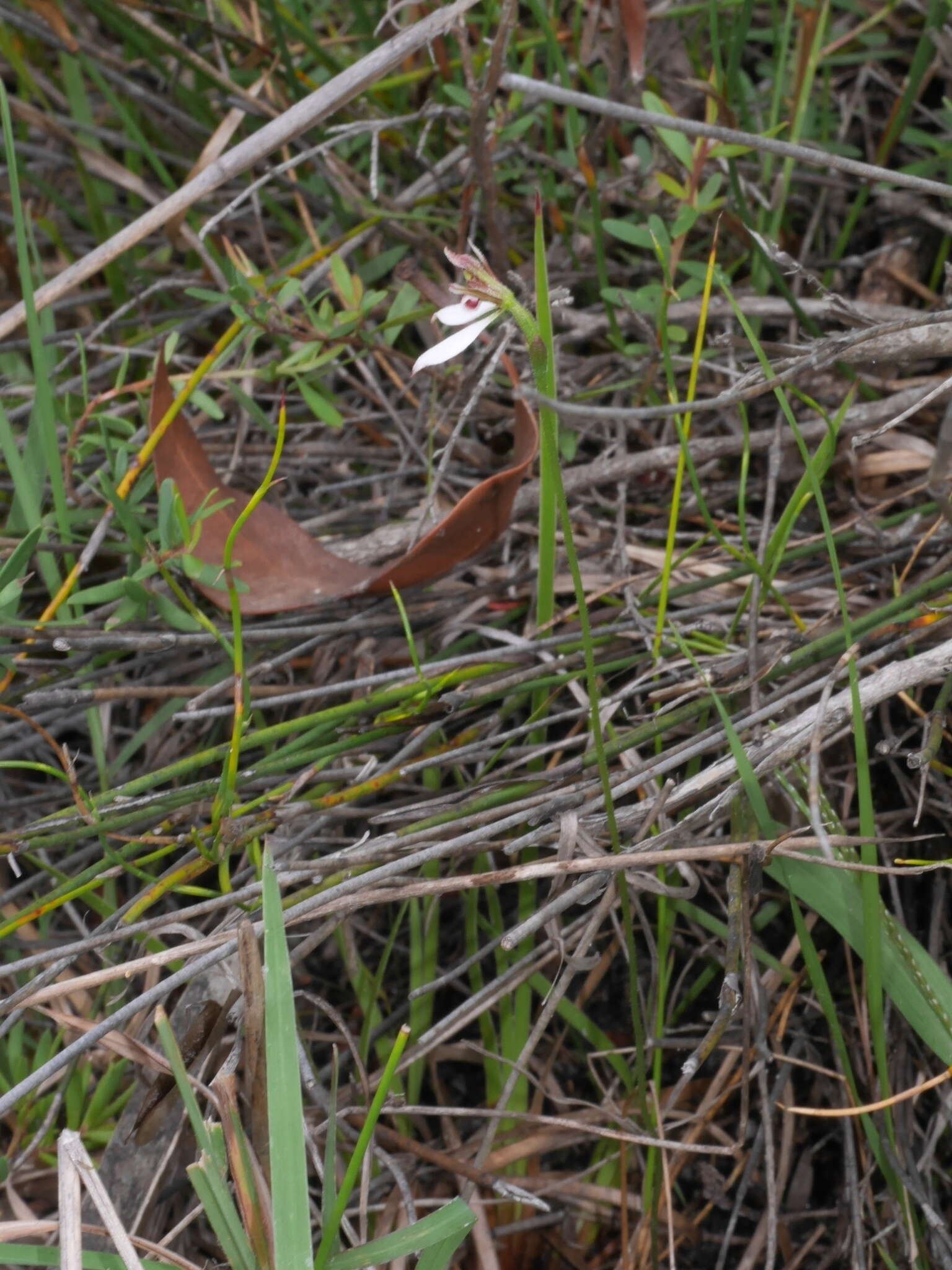 Image of Parson's bands