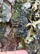 Image of skin lichen