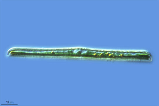 Image of <i>Rhopalodia gibba</i>