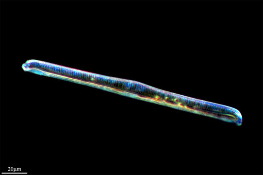 Image of <i>Rhopalodia gibba</i>