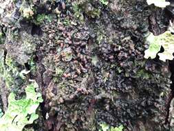 Image of skin lichen