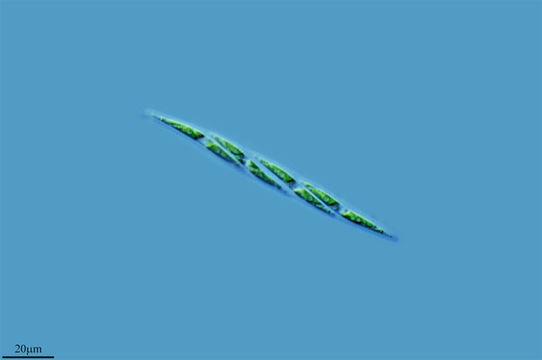 Image of <i>Elakatothrix lacustris</i> Korshikov 1953