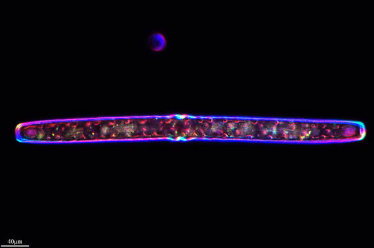 Image of <i>Pleurotaenium trabecula</i>